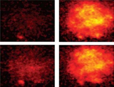First real-time imaging of neural activity invented