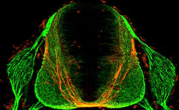 Rockefeller University researchers have discovered a molecule secreted by cells in the spinal cord that helps guide axons (neuron extensions) during a critical stage of central nervous system development in the embryo. The finding helps solve the mystery: how do the billions of neurons in the embryo nimbly reposition themselves within the brain and spinal cord, and connect branches to form neural circuits?