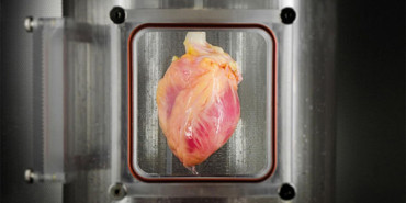 Major steps toward a bioengineered heart for transplantation