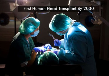 First human head transplant could be achieved by 2030